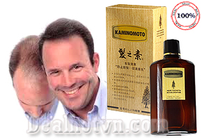 Thuốc kích thích mọc tóc Kaminomoto hàng chính hãng Nhật Bản ngăn ngừa rụng tóc và kích thích mọc tóc trở lại an toàn, hiệu quả gấp 3 lần so với các thuốc thông thường. Giảm giá sốc còn 270.000đ.
