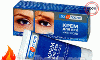 Kem xóa nhăn, vết chân chim, trẻ hoá vùng mắt Kpem chính hãng Nga